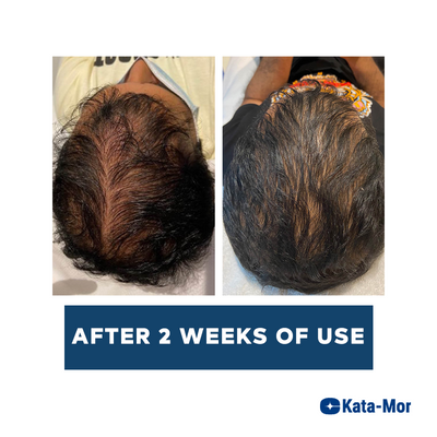 Kata-Mor Advanced Hair Growth Serum