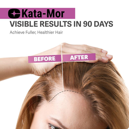 Kata-Mor© - Hair Growth Gummies – Supports Healthy Hair Growth and Strength
