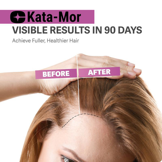 Kata-Mor© - Hair Growth Gummies – Supports Healthy Hair Growth and Strength