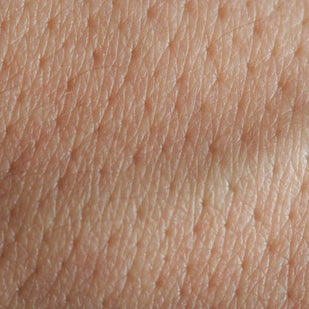 large, sagging pores